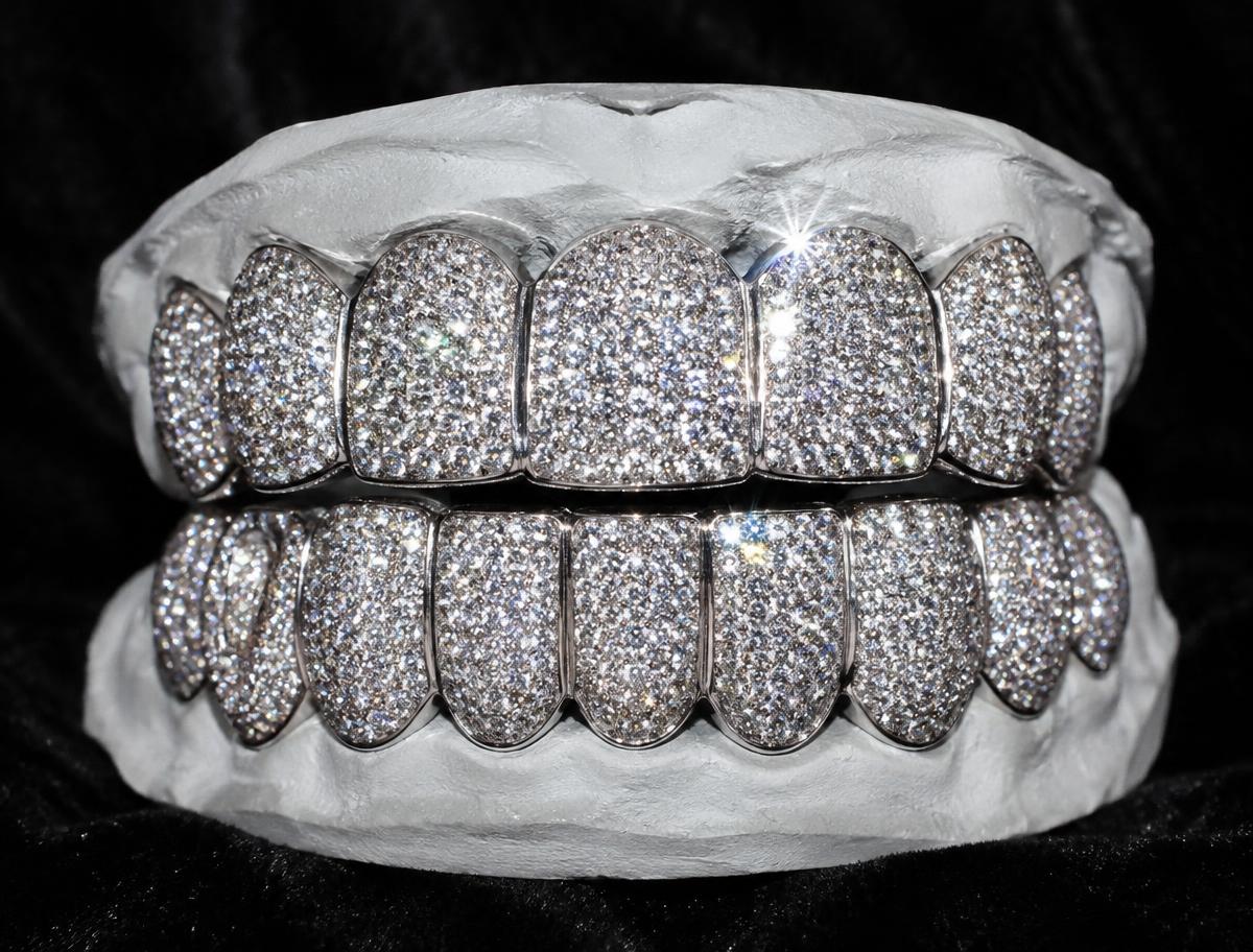 Fully iced white gold grillz set with diamonds on a dental mold